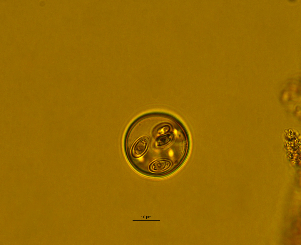 Dictyocha speculum